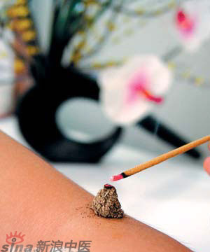 節(jié)氣灸” 冬至，你灸了嗎？