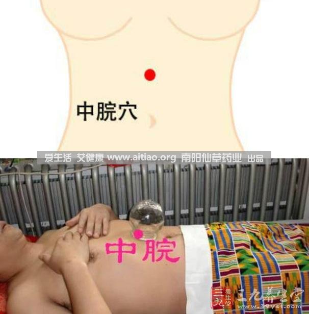 中脘穴位于腹部正中線，臍上4寸的位置上。每天艾灸10-15分鐘，能有效緩解胃部不適的癥狀，同時(shí)有助于祛濕。